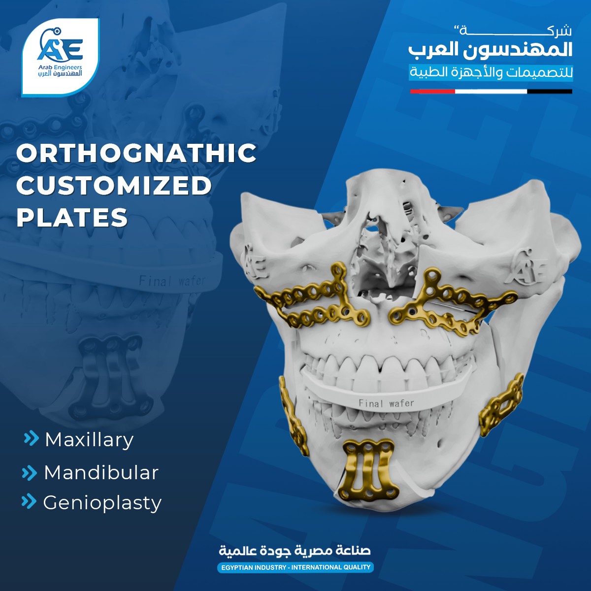 المهندسون - Orthognathic Customized Plates 💀🦷 Covering the full ...