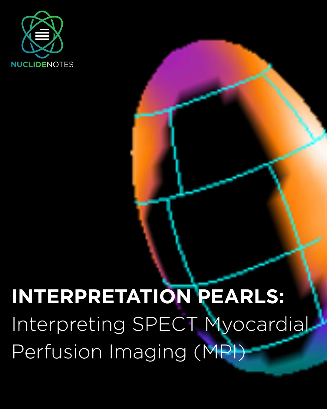 Nuclide Notes - 🫀 SPECT Myocardial Perfusion Case 🗓... | Facebook