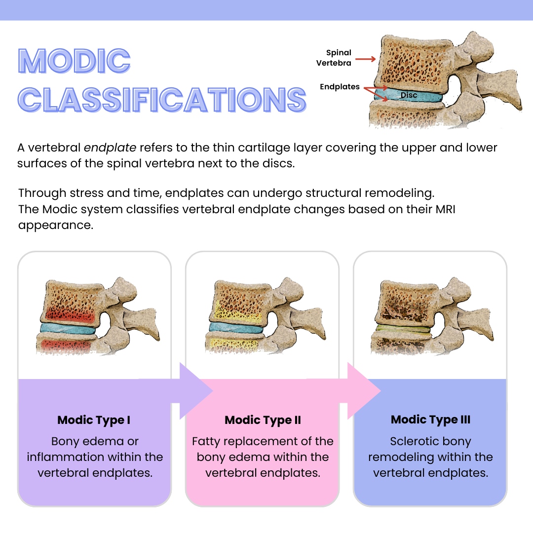 Did you know that the strength and tone of your back muscles might be ...
