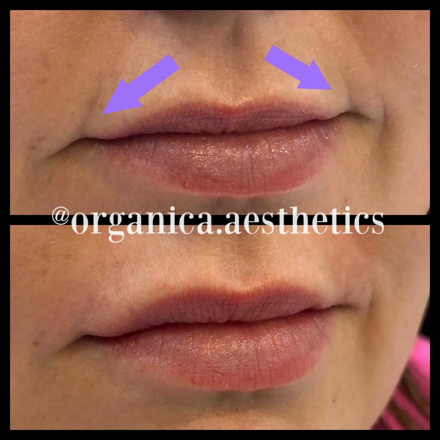 Organica Aesthetics | Round Rock TX