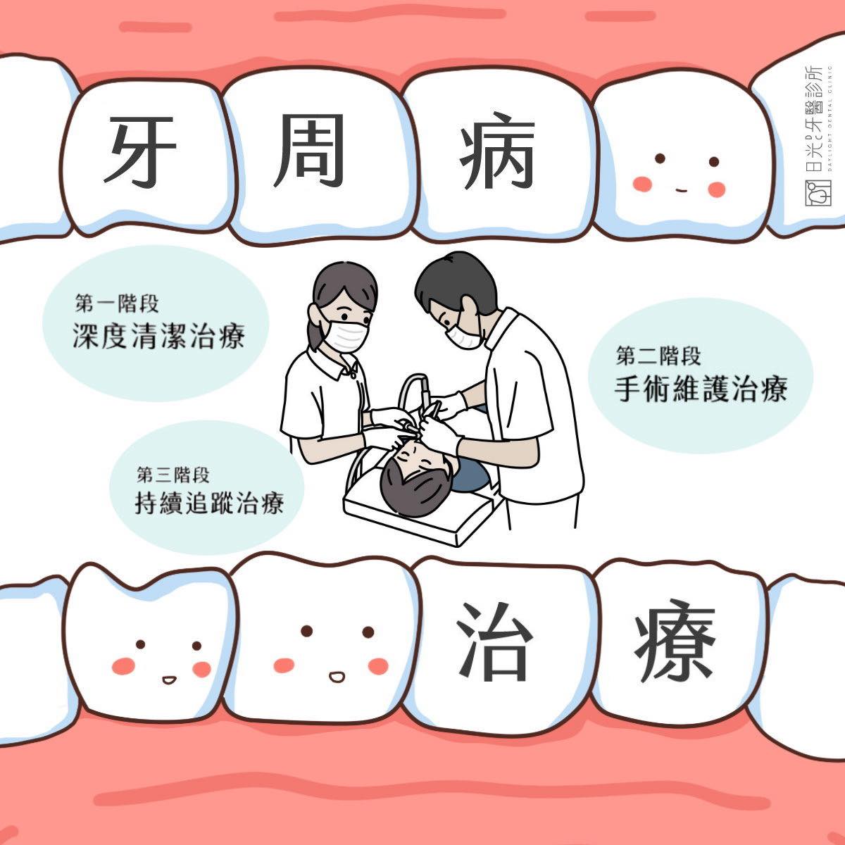 日光牙醫診所 - 【牙周統合治療是什麼？】 牙周病治療並不只是「洗牙」而已。牙周統合治療是針對牙周病分階段、全面性的處理，包含： 🦷初期治療 ...
