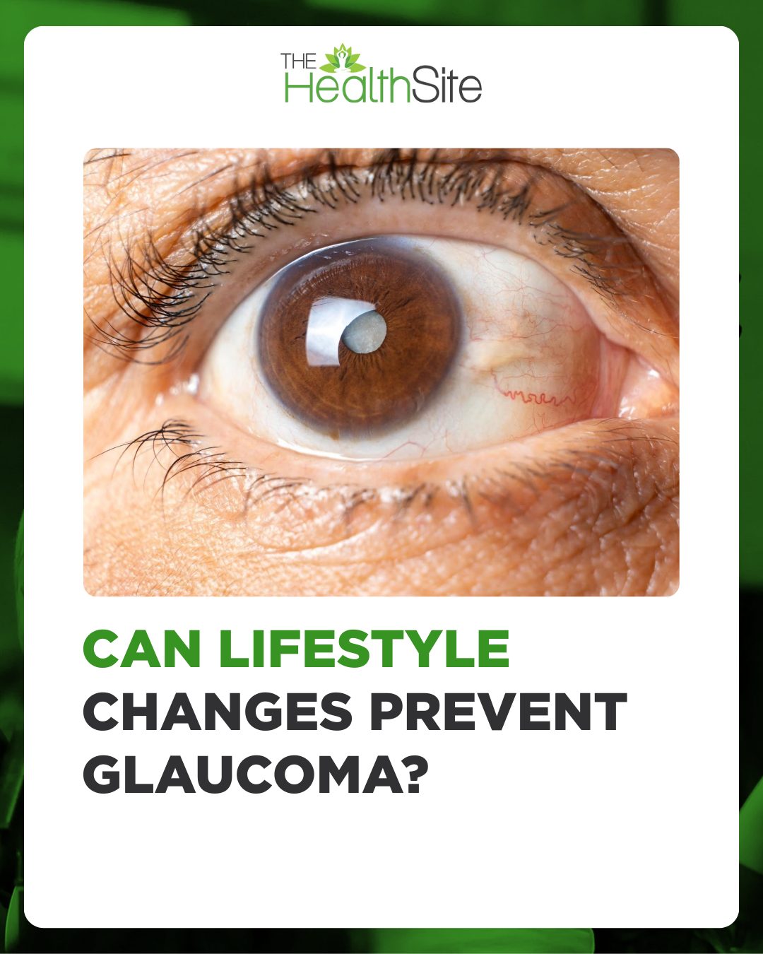 bpc 157 eye sight Glaucoma comprises one of the most prevalent causes of permanent blindness. Glaucoma is progressive eyesight loss disease that develops with minimal symptoms until very substantial visual loss occurs B12 shot