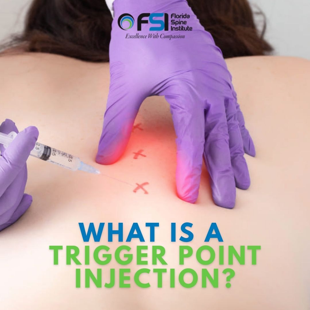 Florida - Trigger point injections help relieve tight, painful knots in ...
