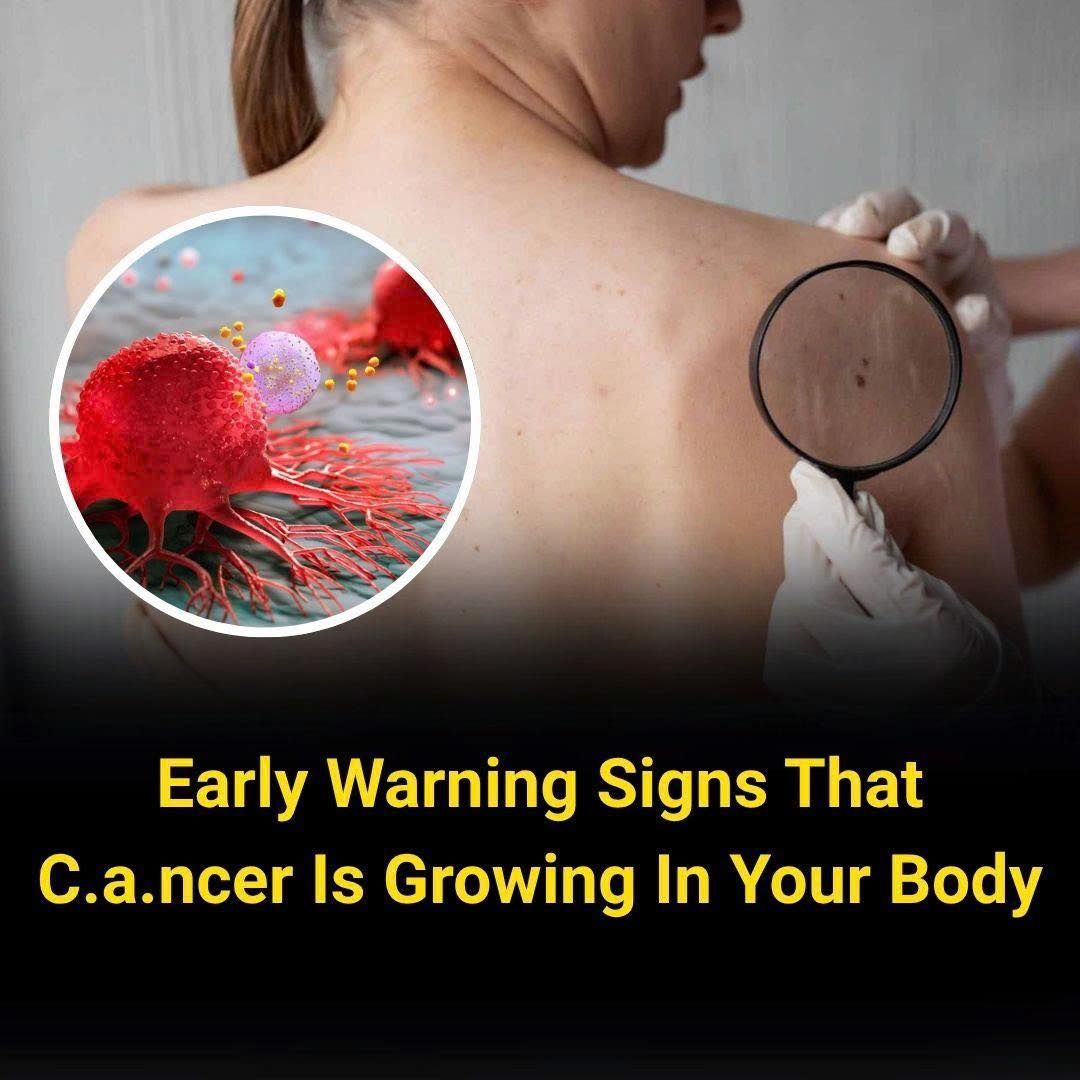 Video - These Silent Symptoms Could Be Early Signs of C.an.cer — Know ...