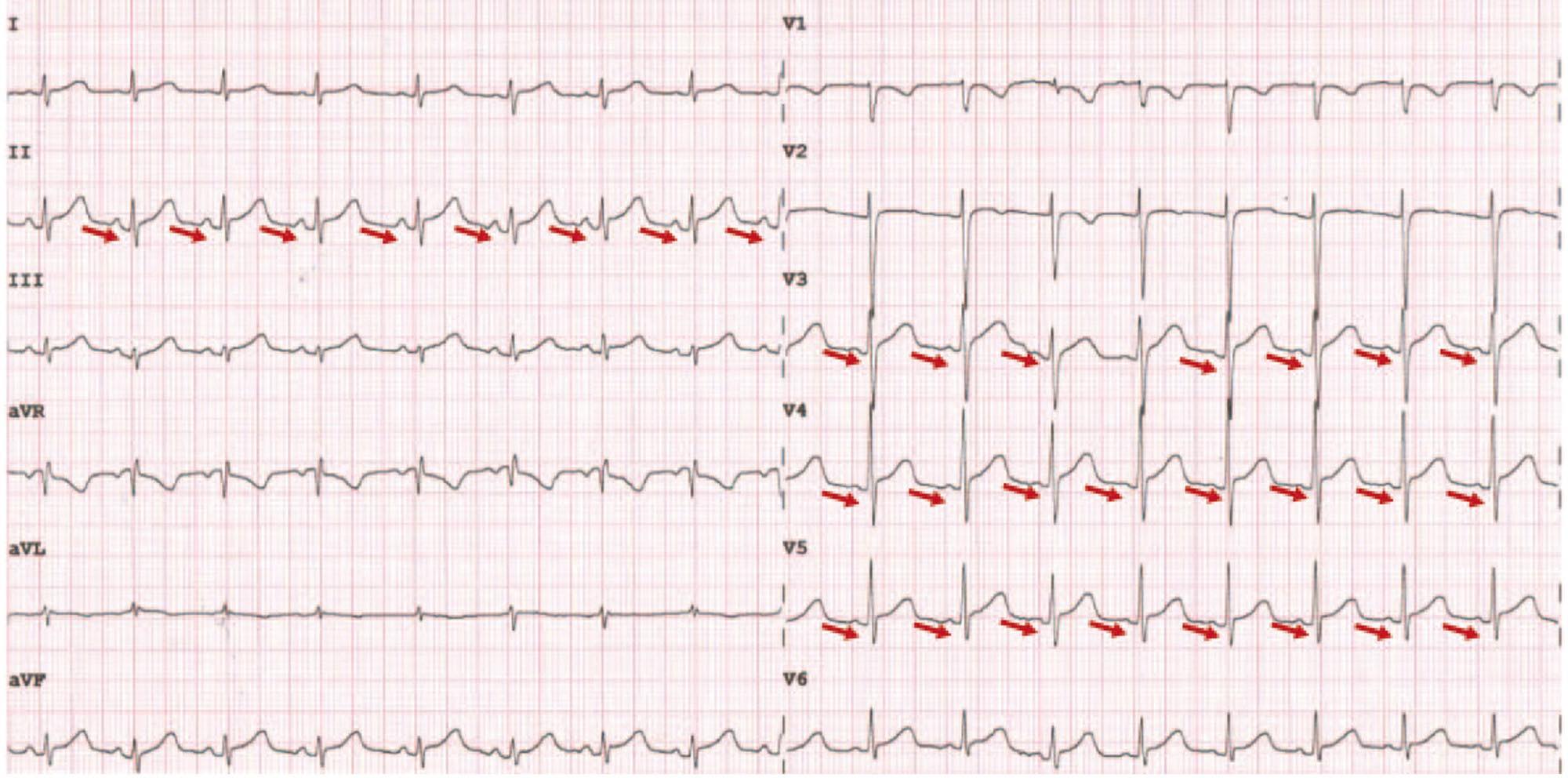 Cardiophilia - A middle aged male with chest pain. | Facebook