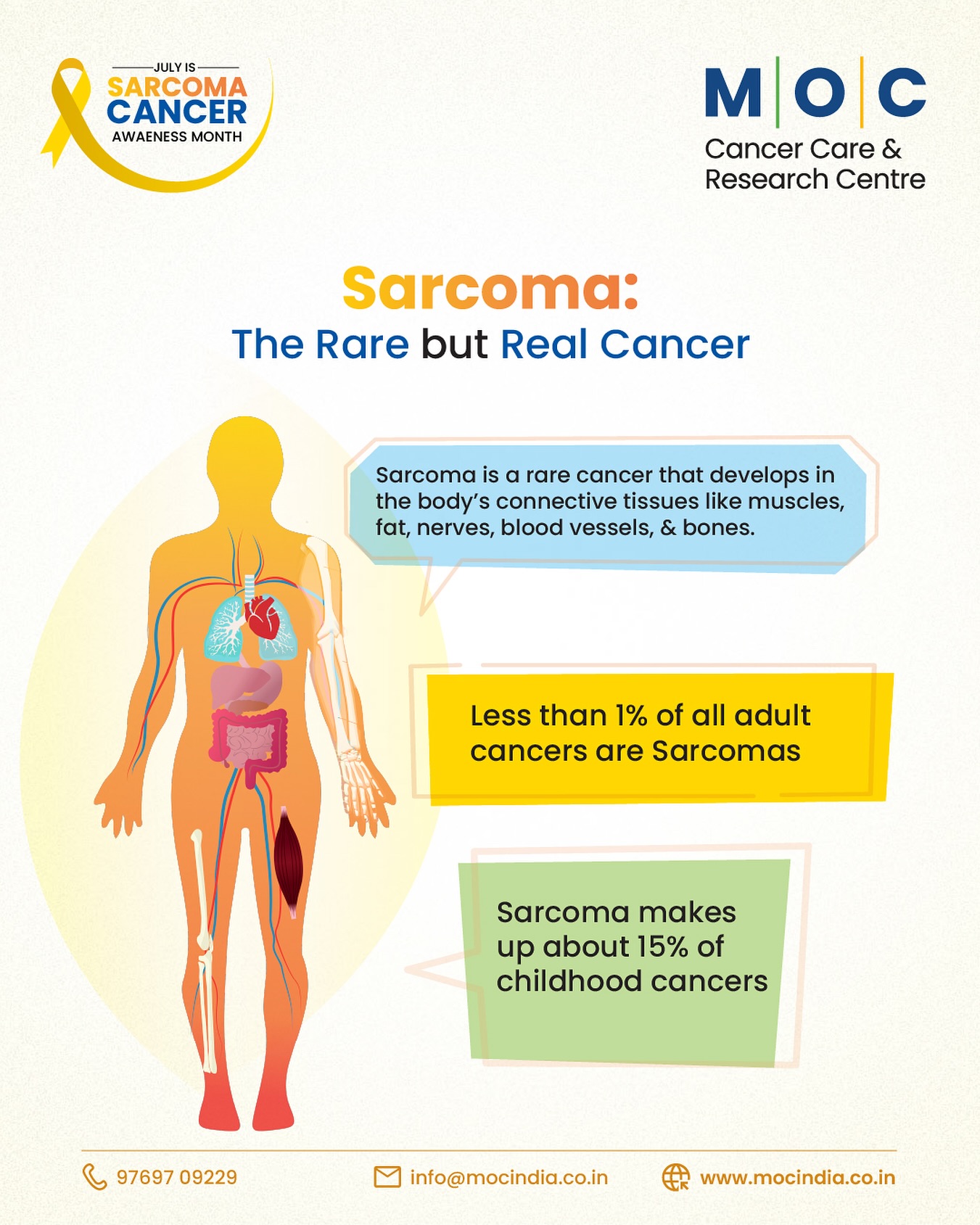 MOC India - Sarcoma: The Silent Threat in Connective... | Facebook