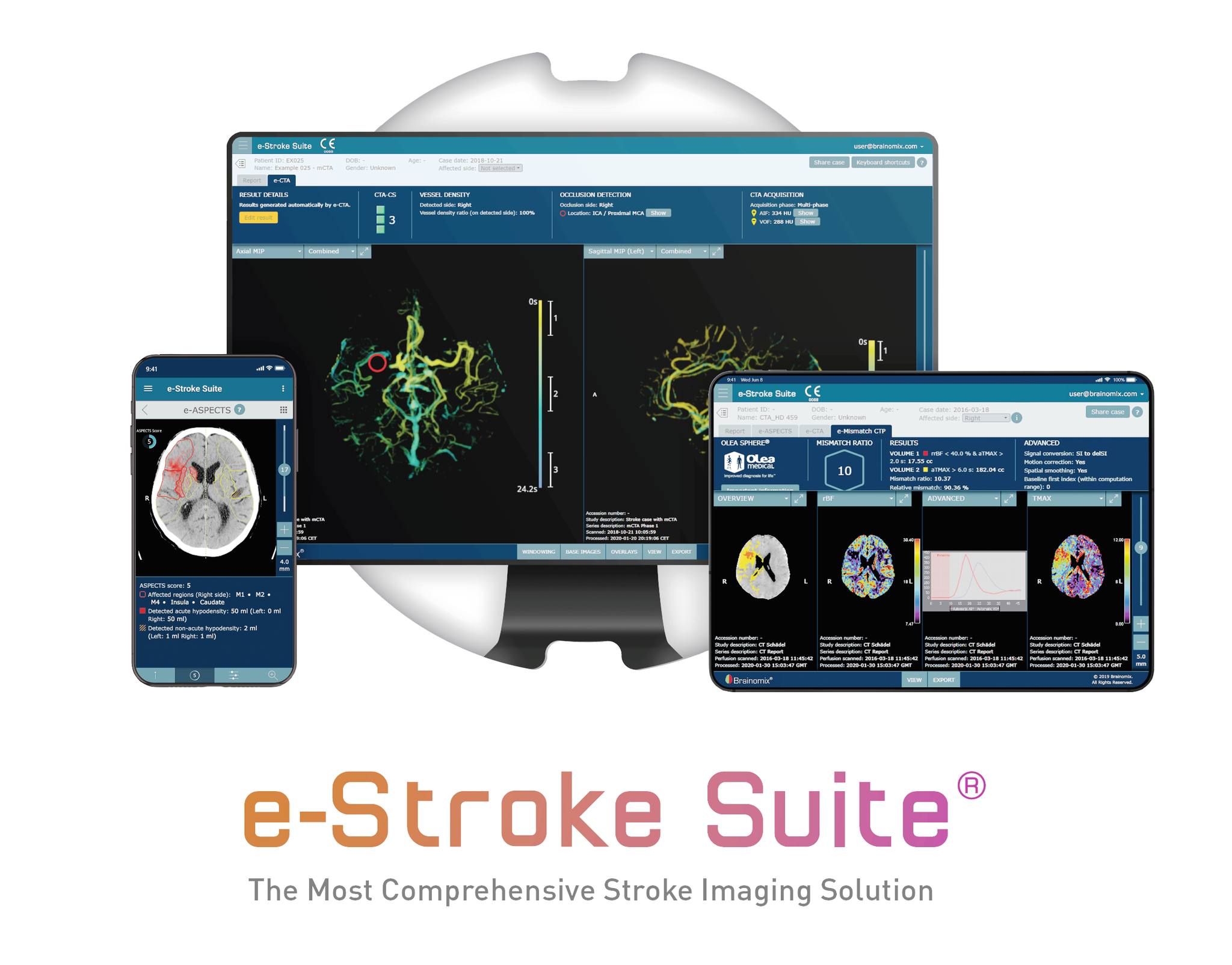 蘇柏全自寫《商業實務個案》- - 【自寫商業實務個案】 「英國 Brainomix 360 Stroke (前稱 e-Stroke) 人工智慧 ...