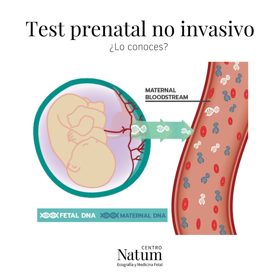 centro-natum-conoces-el-test-prenatal-no-invasivo-se