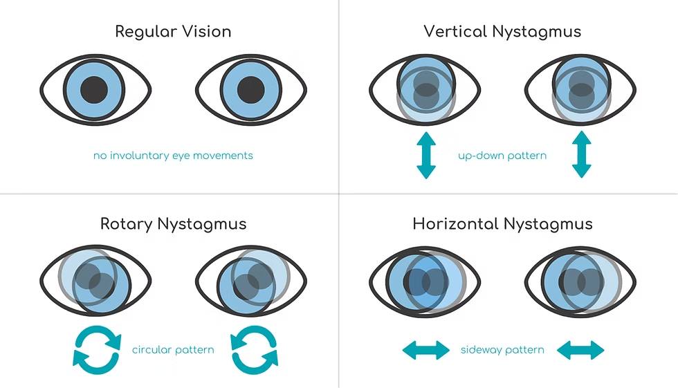 va-optometry-centre-singapore-singapore