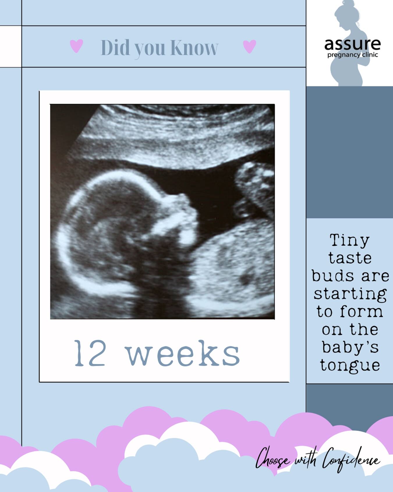 Assure - Did you know? At just 12 weeks – when your baby is still ...