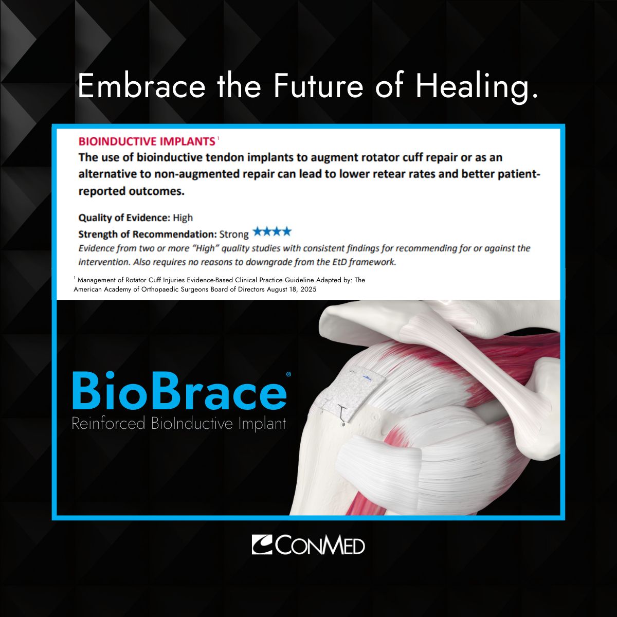 📢 Big news from AAOS: New guidance strongly recommends the use of bioinductive implants in rotator cuff repair. Why does this matter? ✓ Bioinductive implants promote new tissue growth ✓ Only two