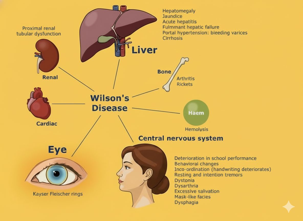 Wilson disease is a genetic disorder resulting in excessive accumulation of copper in the body. People with Wilson disease are unable to excrete copper, therefore, over a period of time copper slowly