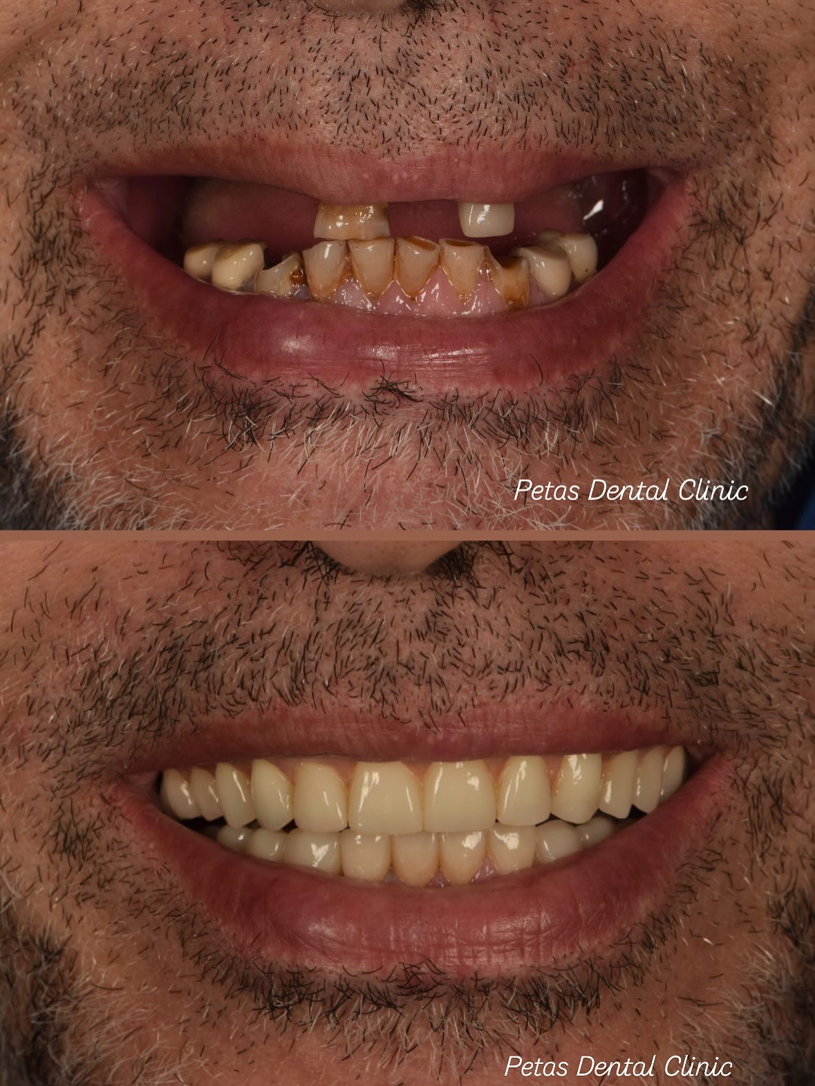 Petas Dental Clinic | Ródos