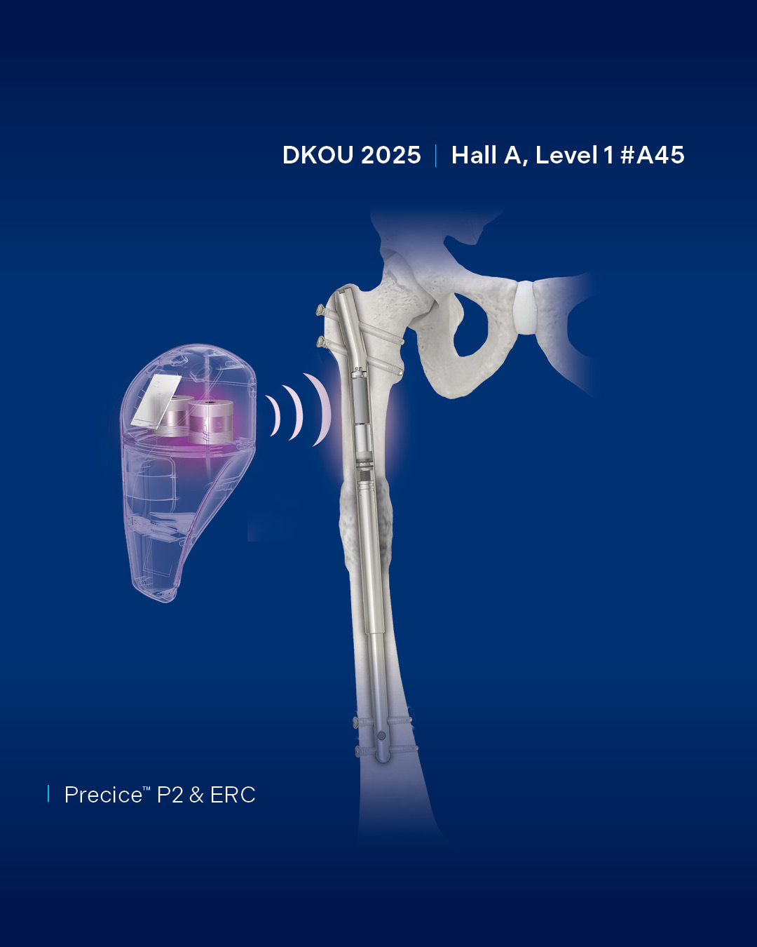 Globus Medical - Visit us at DKOU 2025 in Berlin, Germany,... | Facebook
