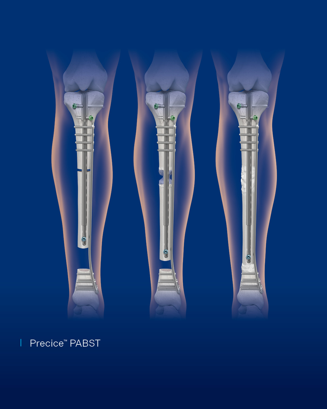 Globus Medical - Visit us at DKOU 2025 in Berlin, Germany,... | Facebook
