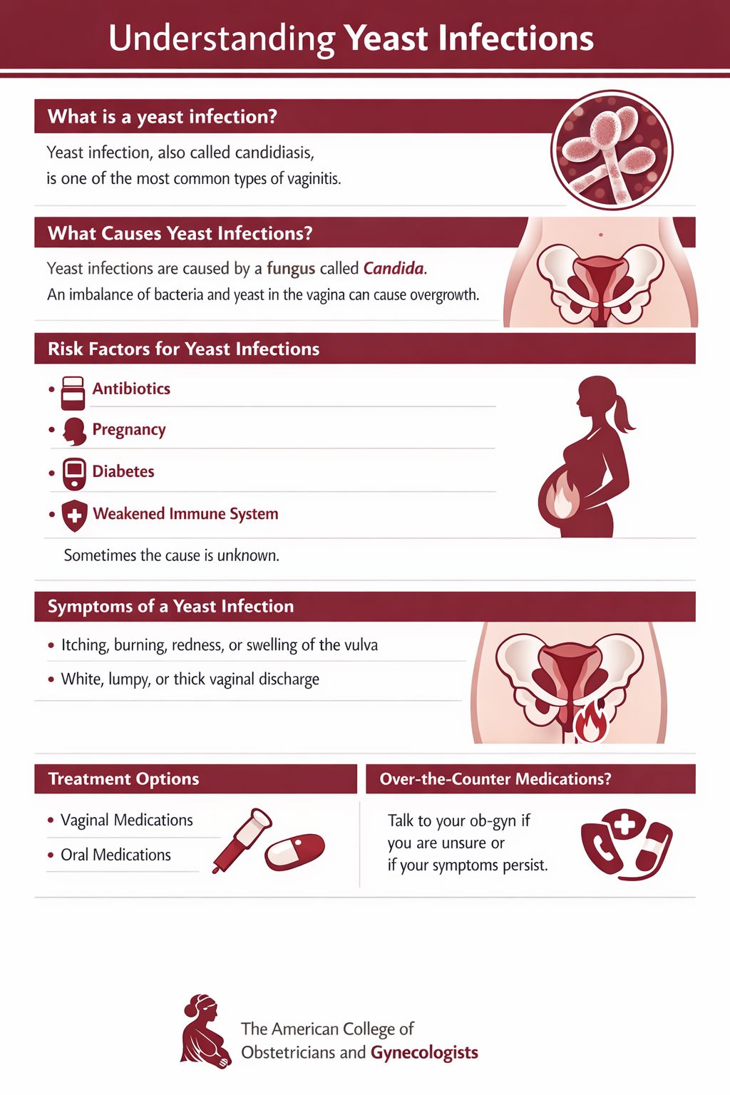 The Itch That Needs a Switch: A No-Nonsense Guide to Yeast Infections 💡 ...