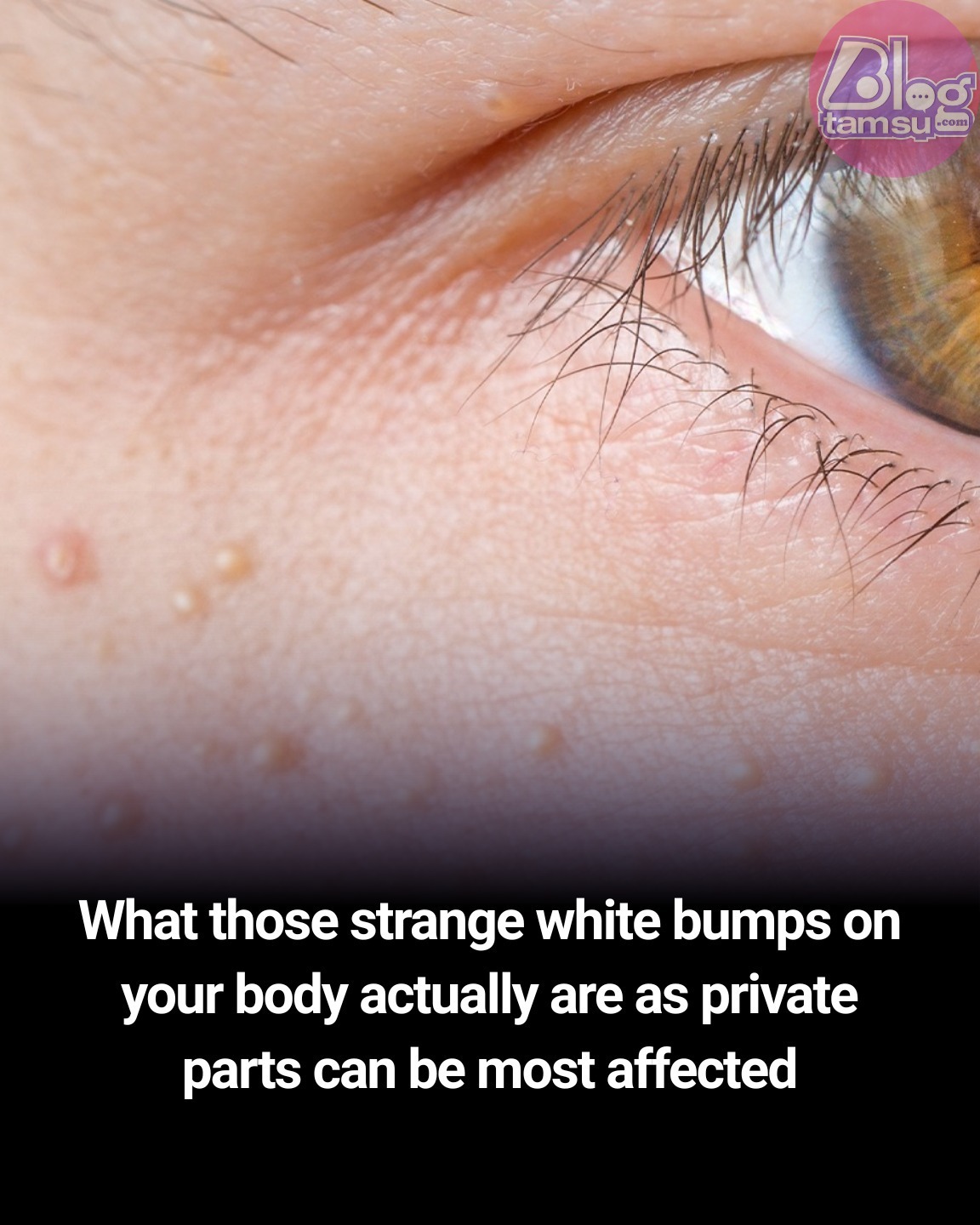 Feedy - They’re more common than you might think 😲 | Facebook
