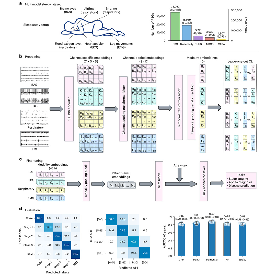 Nature - A paper published in Nature Medicine presents SleepFM: a ...