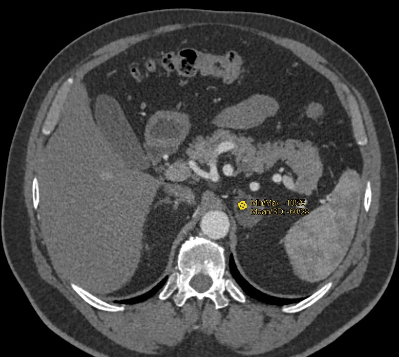 CTisus: Cutting edge information on body CT (Computed tomography ...