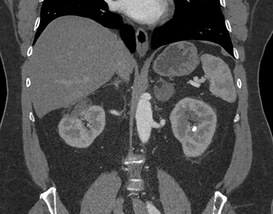 CTisus: Cutting edge information on body CT (Computed tomography ...