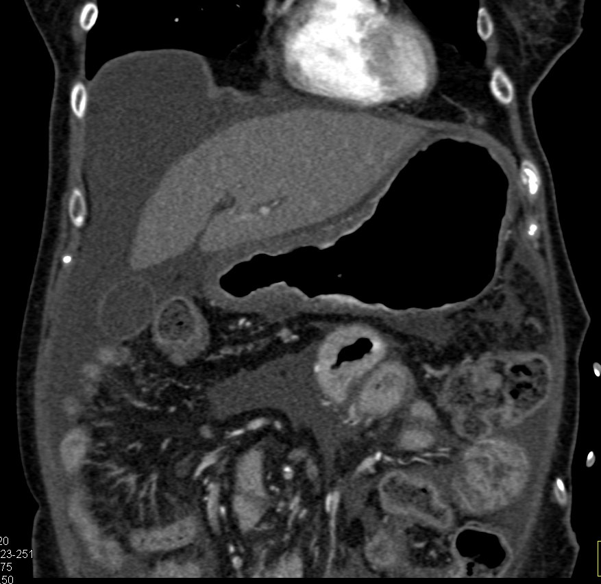 CTisus: Cutting edge information on body CT (Computed tomography ...