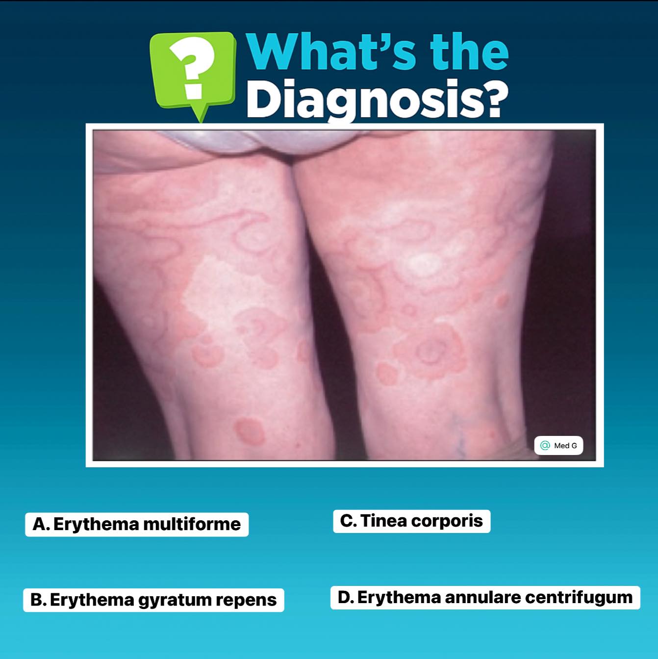 Med - A 68-year-old man presents with a rapidly spreading red rash on ...