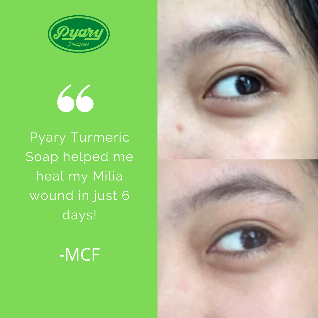 For minor skin problems, choose Pyary... - Pyary Philippines | Facebook