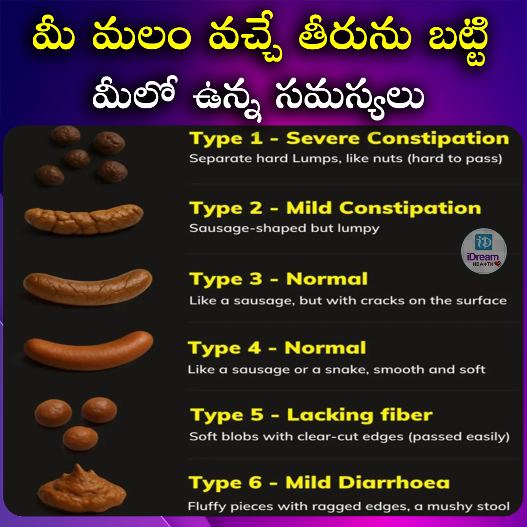 IDream Health - మీ మలం వచ్చే తీరును బట్టి మీలో ఉన్న... | Facebook
