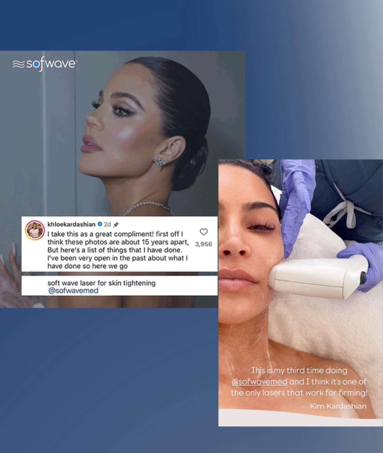 ✨ What non-invasive treatment are the celebrities obsessed with
