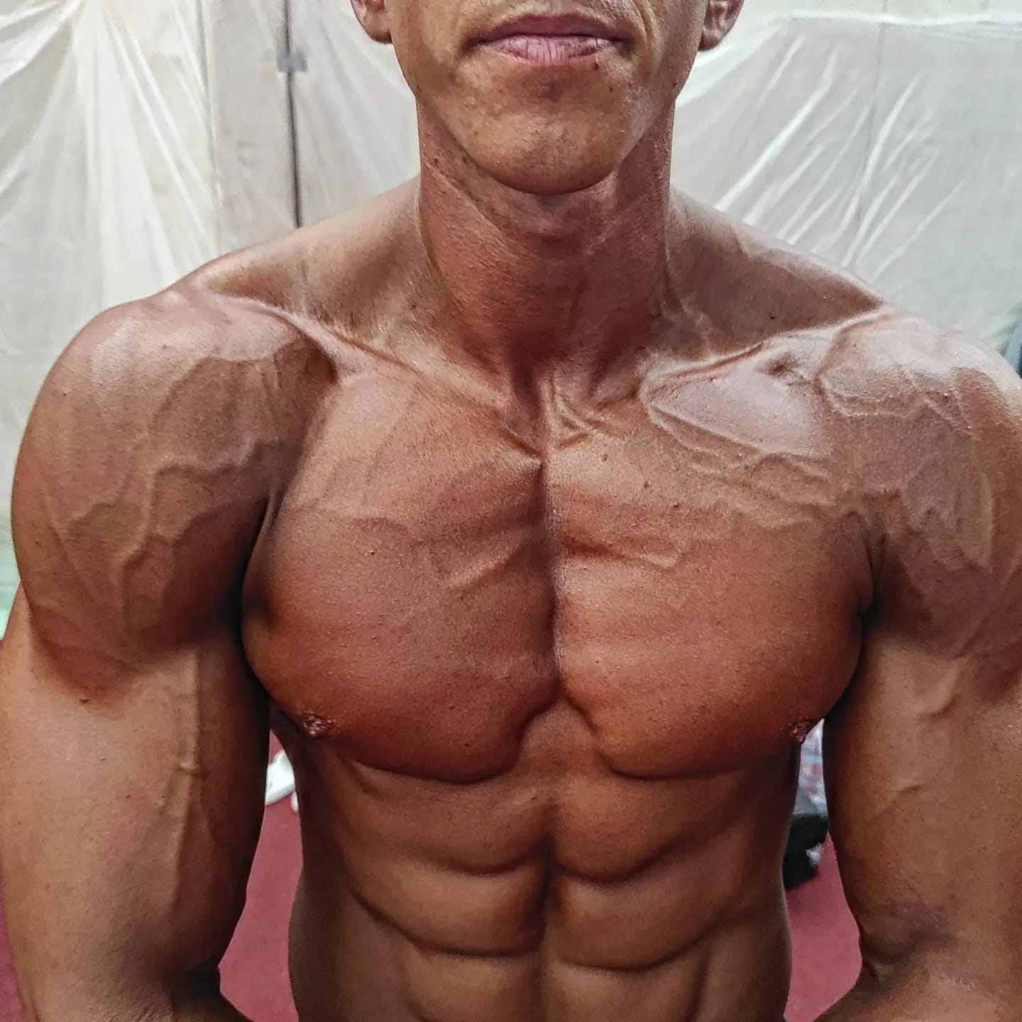 Aesthetic Army - Peter Rosta Team