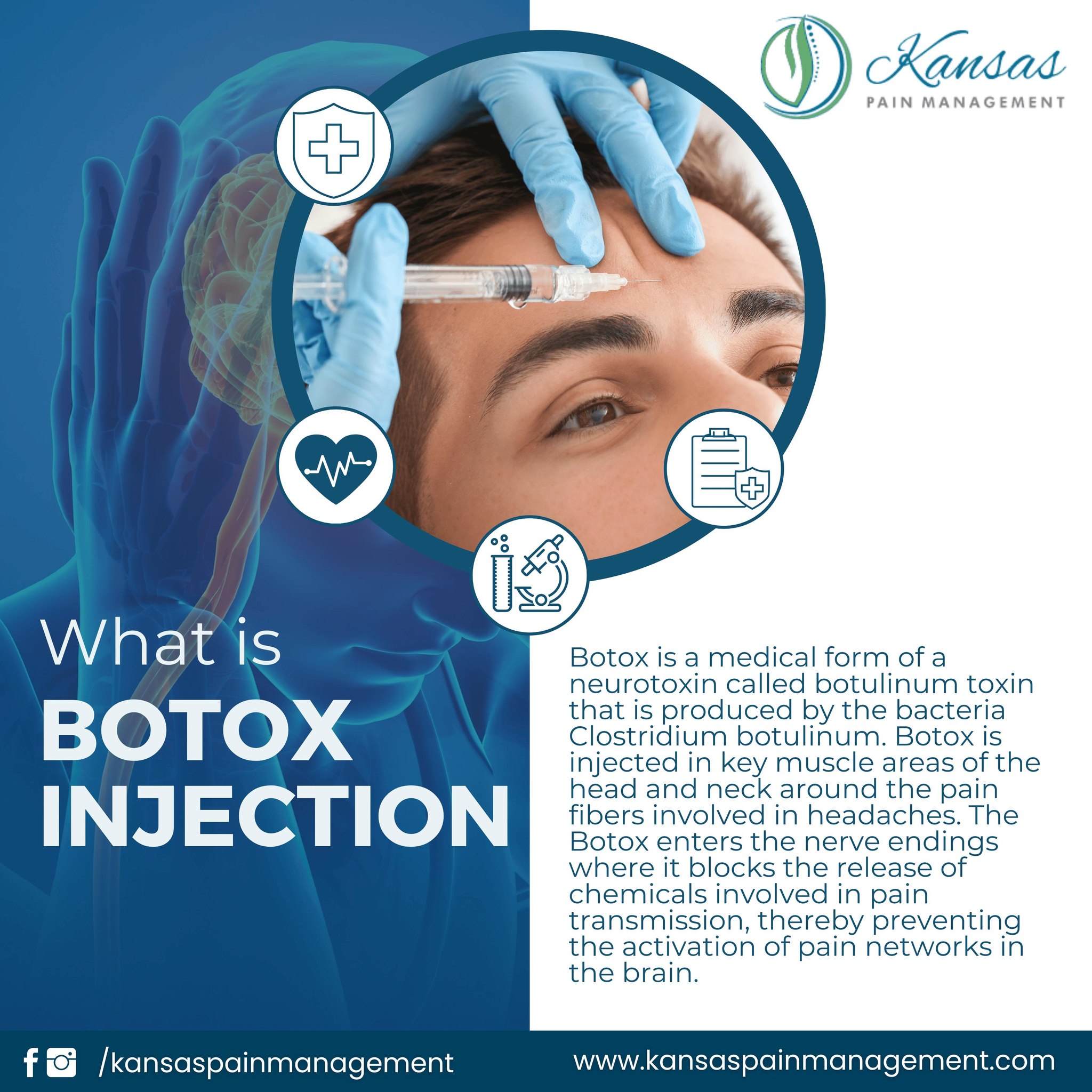 Kansas - Botox injections are a proven treatment option for managing ...