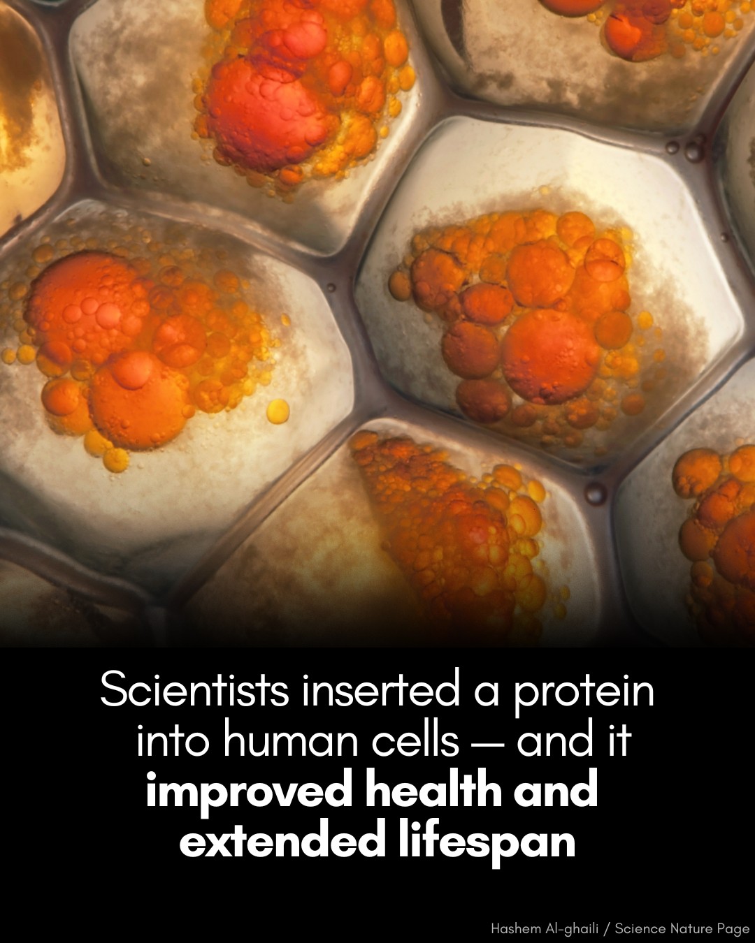 Hashem - 🧬 A new discovery could pave the way for REAL anti-aging ...