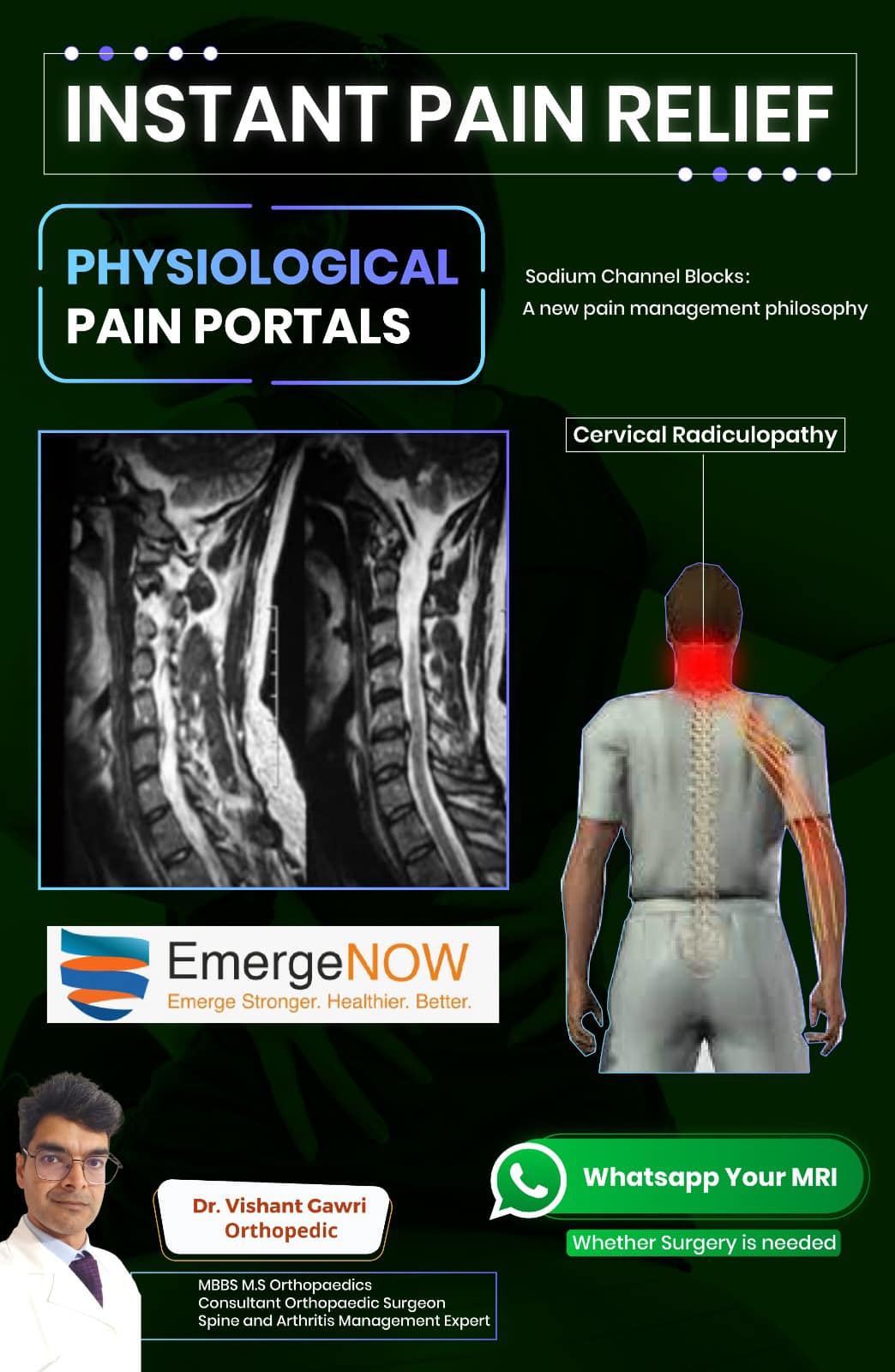 Dr.VishantGawri - Instant Pain Relief from Cervical Radicular Pain ...