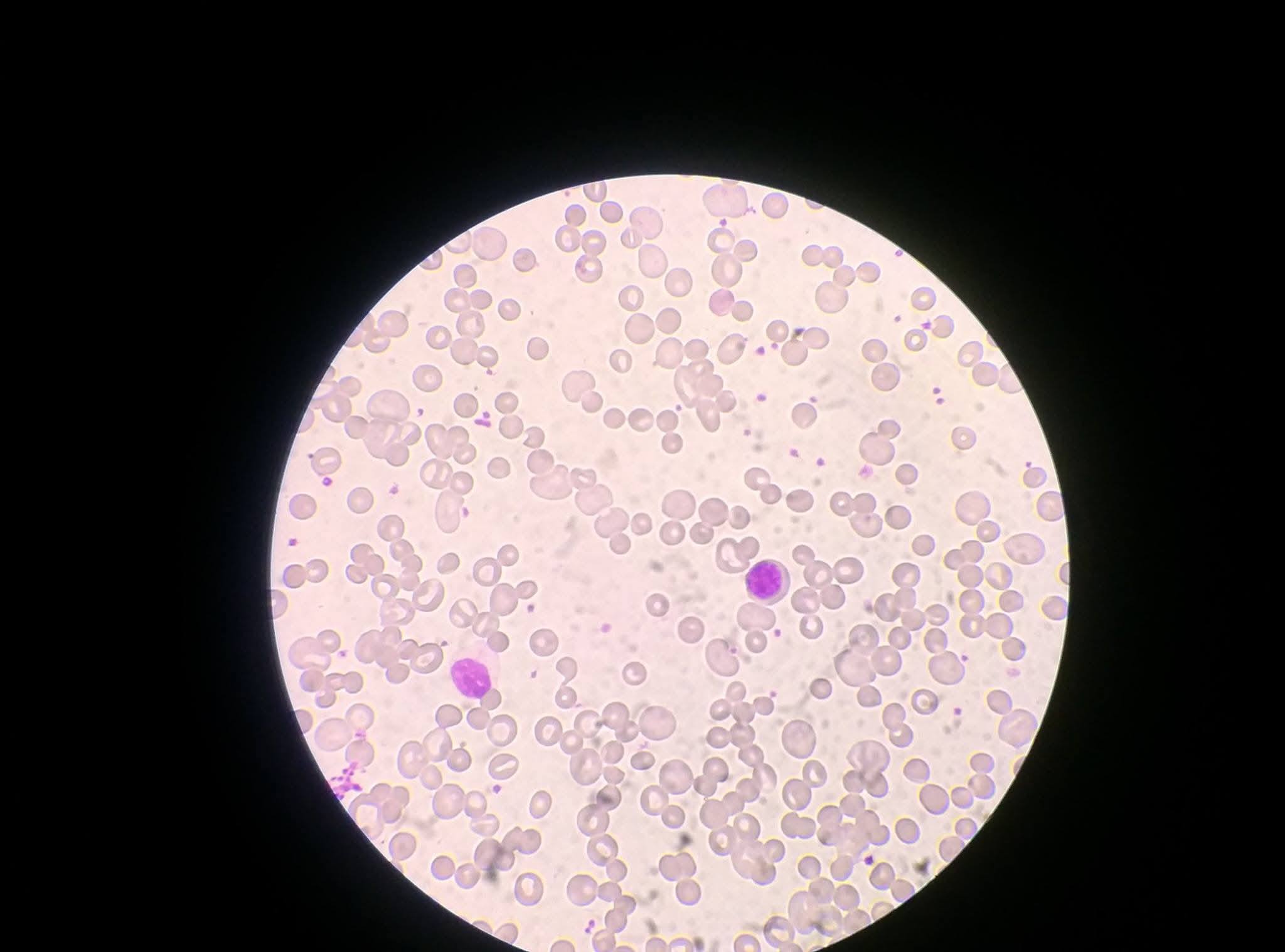 Medical Lab Zone added a new photo. - Medical Lab Zone