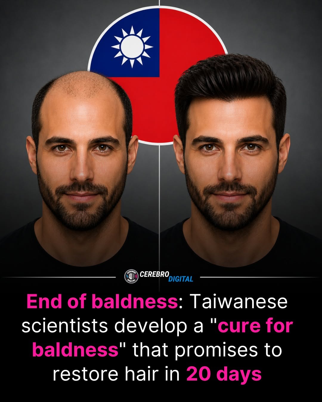 foxo4 dri hair loss RESEARCHERS IN TAIWAN DEVELOP TOPICAL TREATMENT TO REACTIVATE GROWTH IN DORMANT FOLLICLES A team from National Taiwan University identified a cellular mechanism capable of awakening dormant hair follicles using a topical by_breed Weight:20mg GHK-Cu Side Effects: Skin