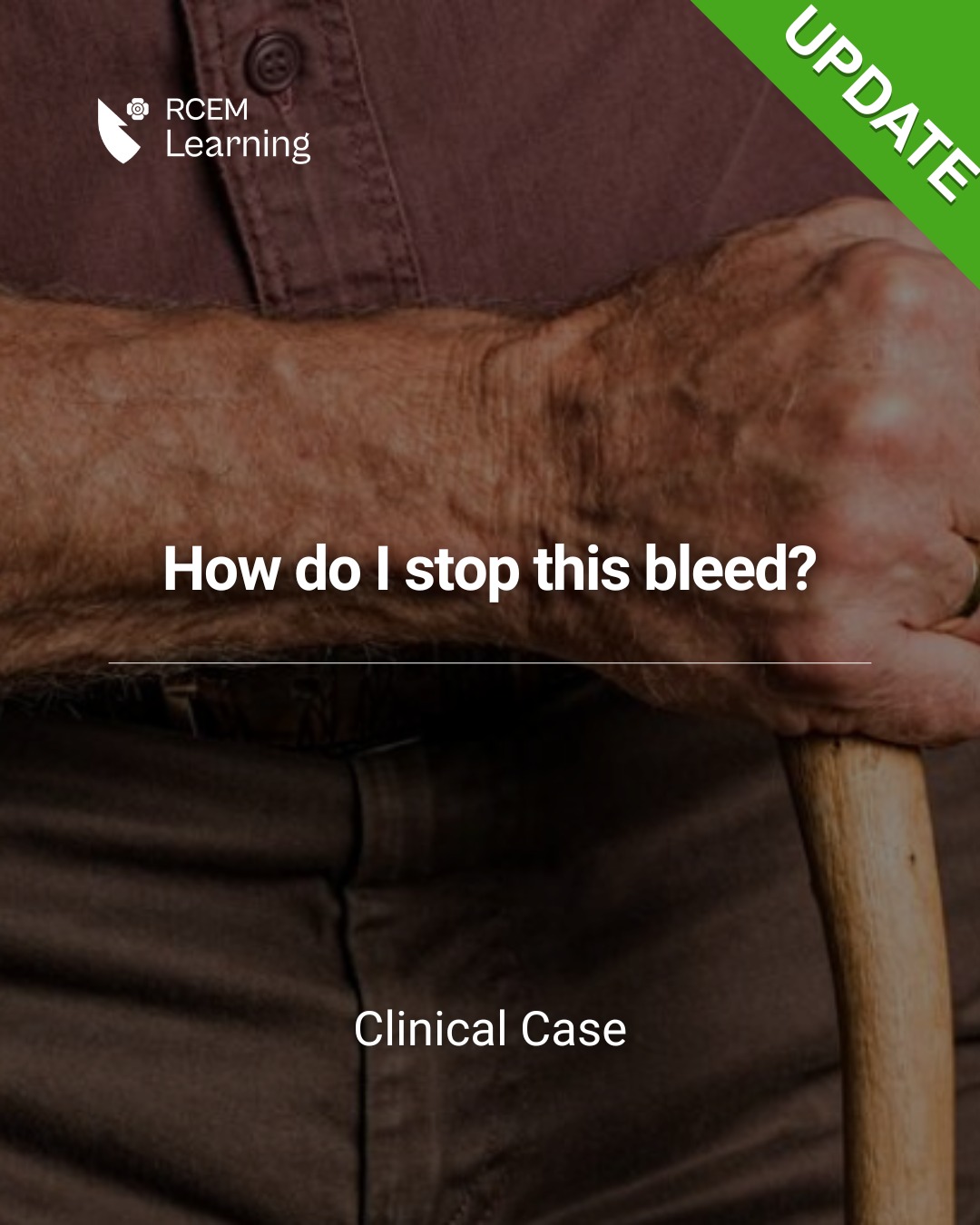 RCEMLearning - UPDATE: An 80-year-old gentleman is brought... | Facebook
