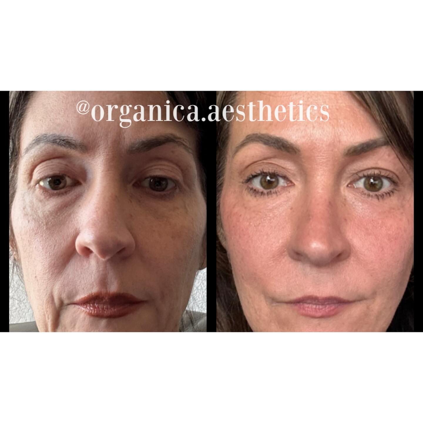 Organica Aesthetics | Round Rock TX