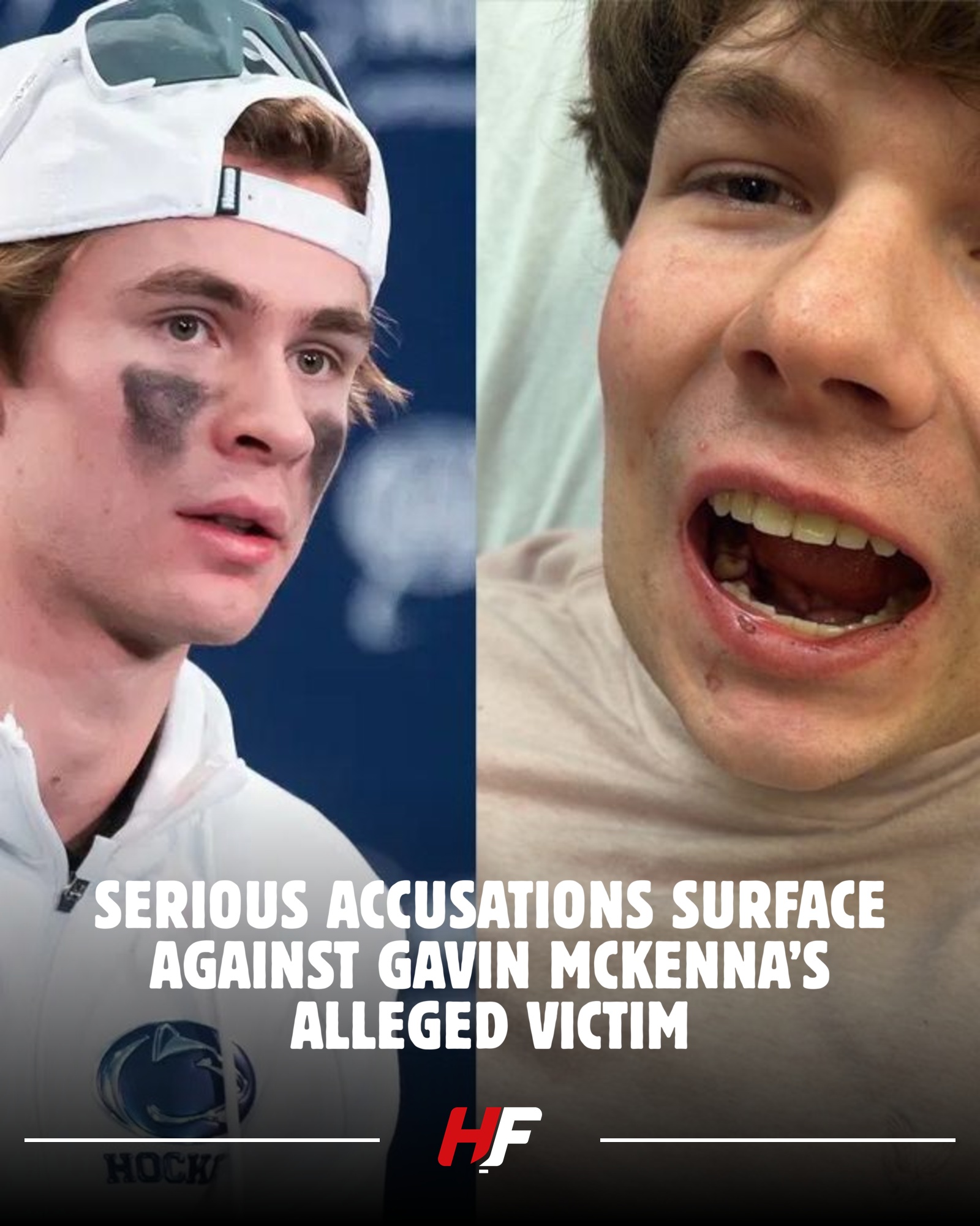 Hockey - Many are questioning the conduct of the man involved in the ...