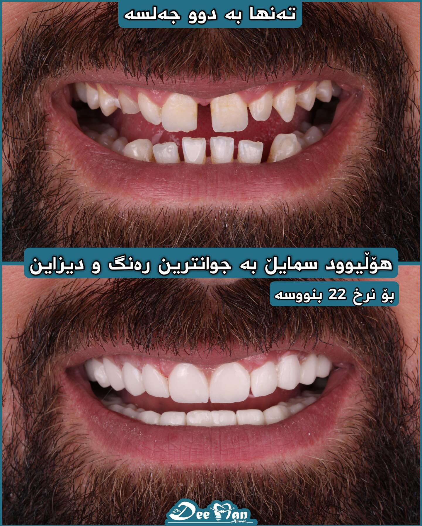 پزیشکی ددان - پێشبڕکێ و دیاری هەفتانە (۲) ئەم حاڵەتە دوای چەند ...