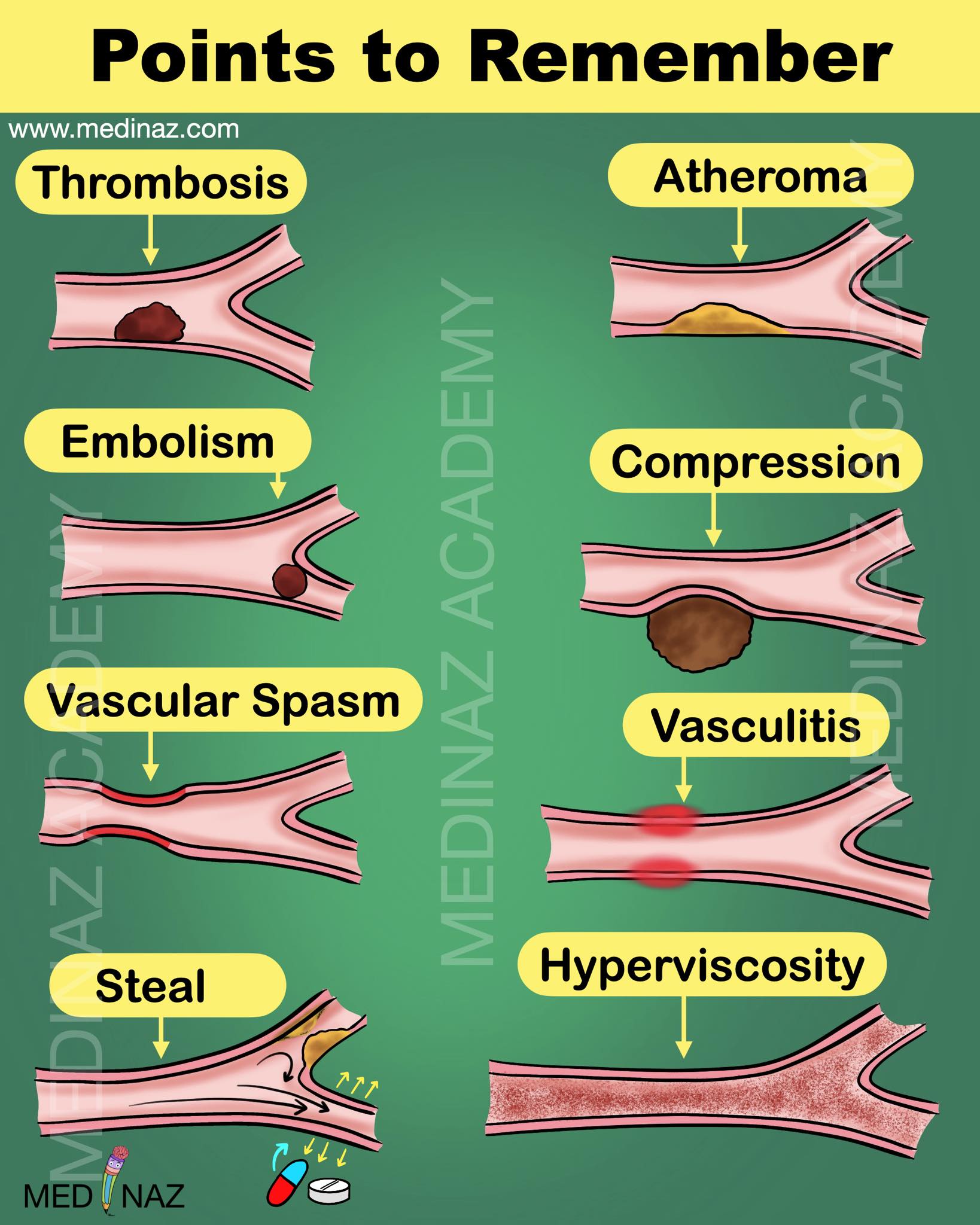 Medinaz - 🔹 Thrombosis ️ Intravascular blood clot formation in intact ...