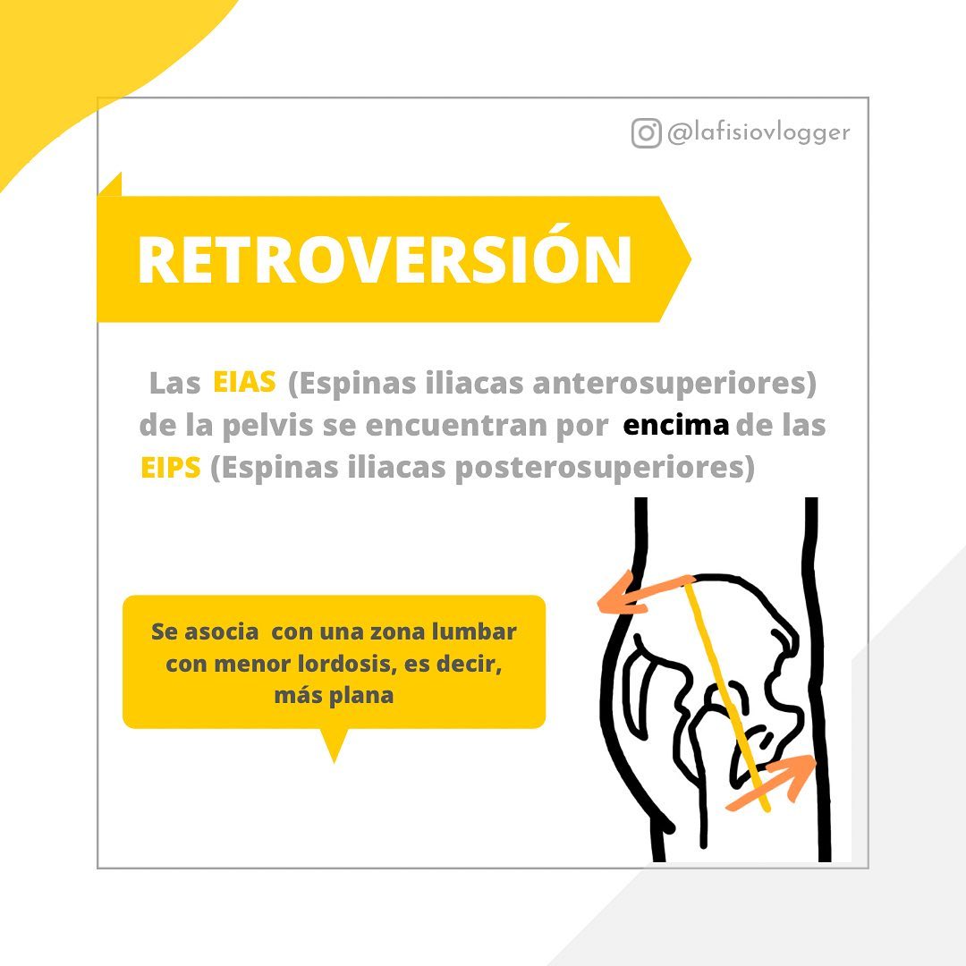 La FisioVlogger - 🔅La anteversión y la retroversión son...