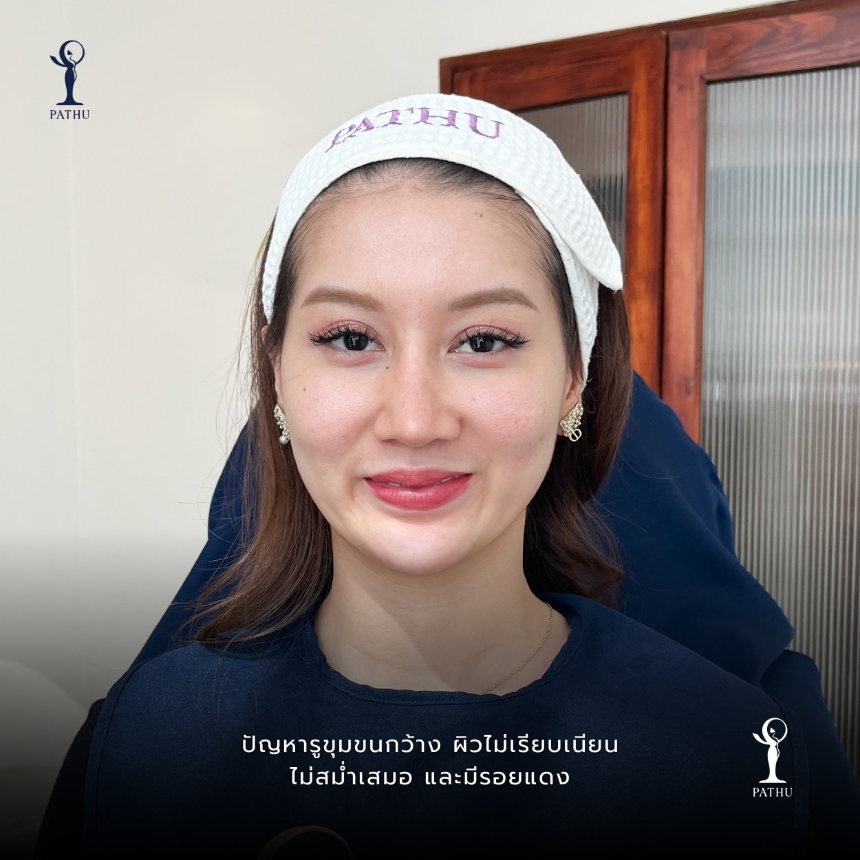 Pathu - #คือติดแบบต้องทาทุกคืนอ่ะนะ STAY C-50 ส่วนผสมหลักของไนท์แคร์ ...