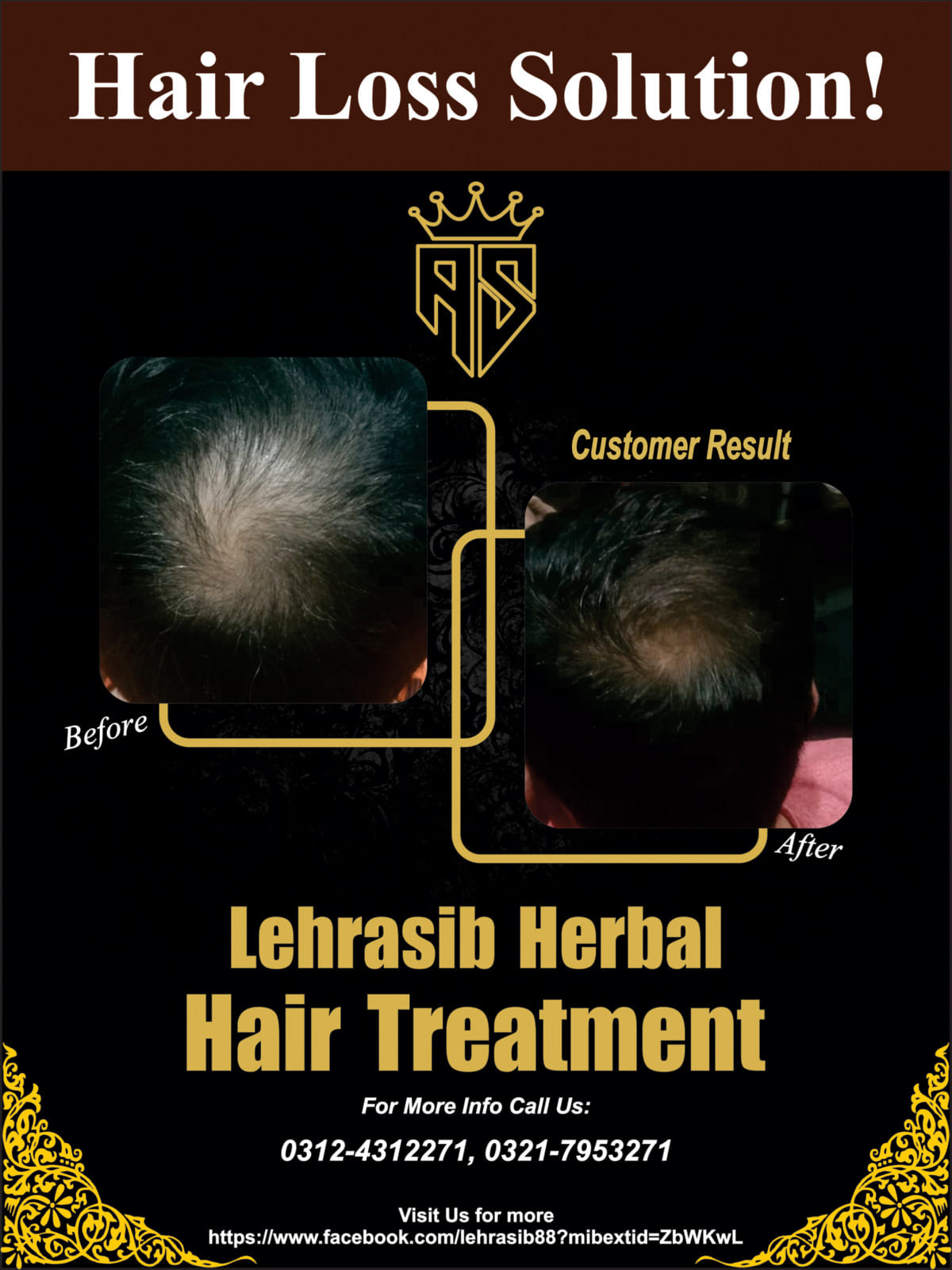 Lehrasib Herbal Hair Treatment - What are the benefits of using ...