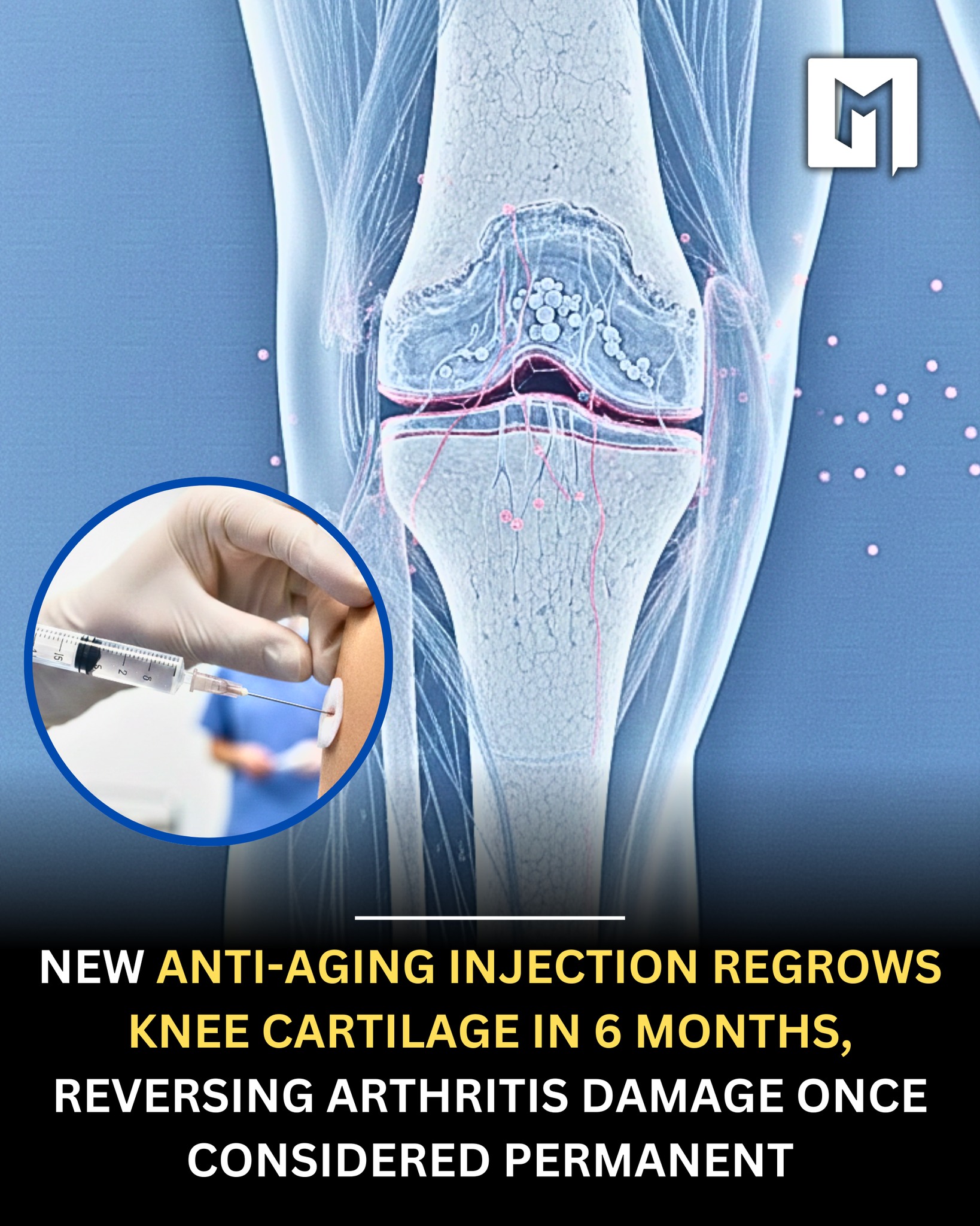 Could 15-PGDH inhibitors help regenerate hip cartilage?