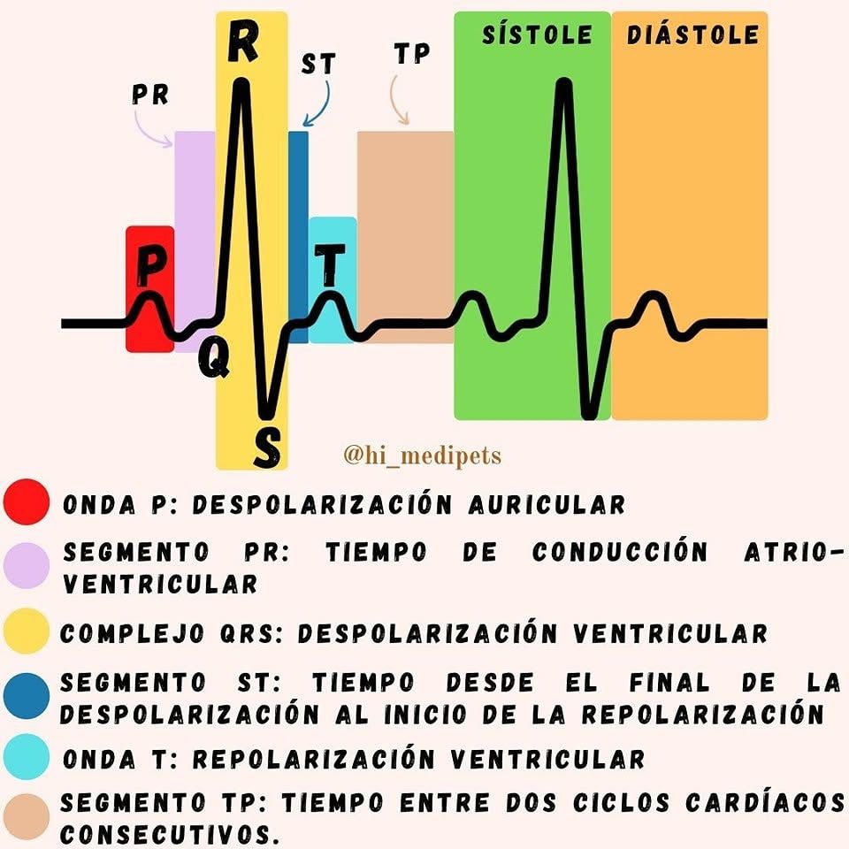 Medicina - ️🩺 ️El electrocardiograma es el conjunto de ondas y un ...