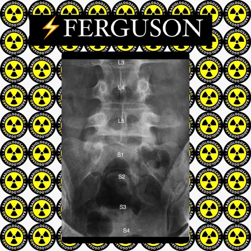 Radiologos.arg - ⚡️RX FERGUSON #anatomia #huesos #radiologia # ...