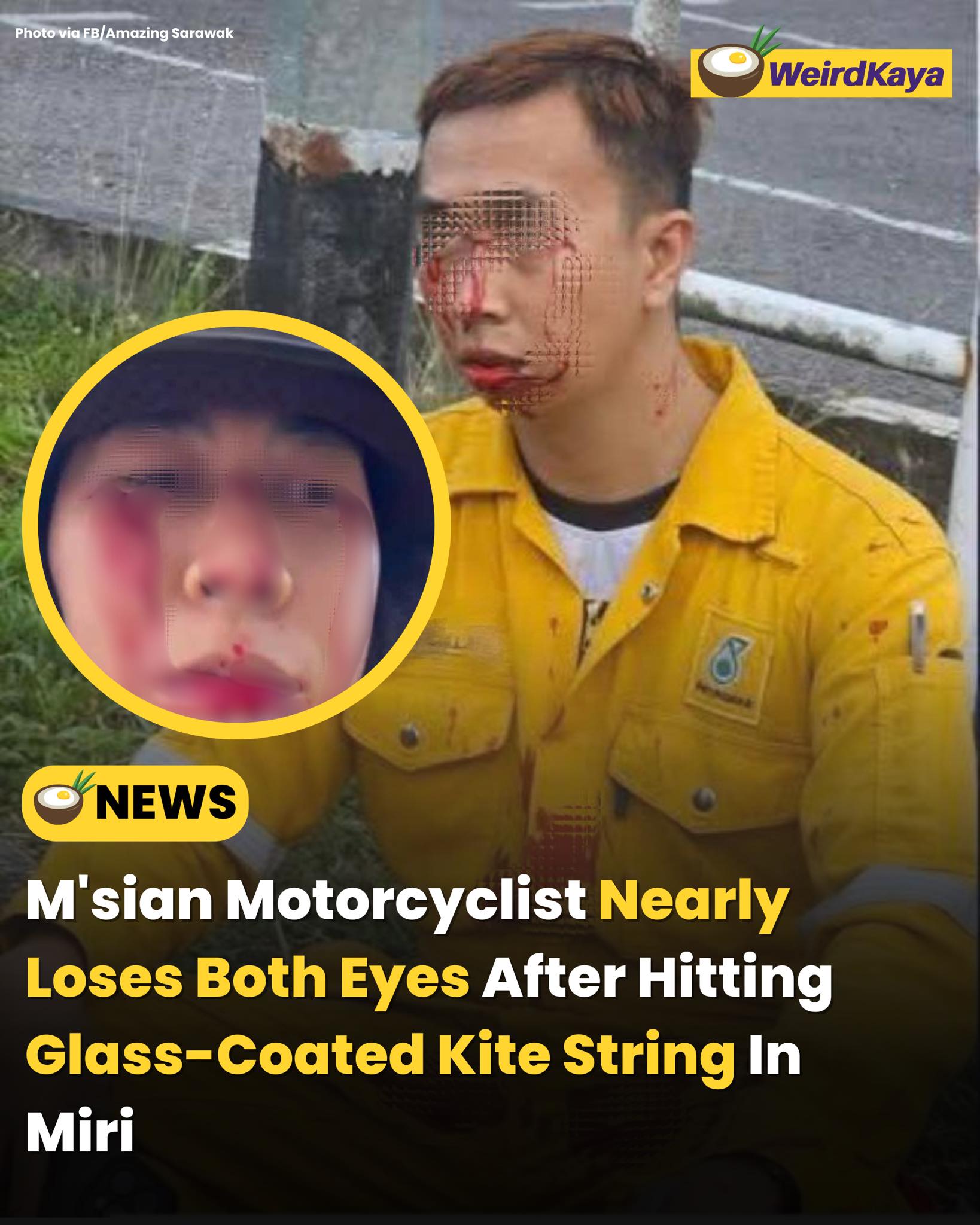 WeirdKaya - A man in Miri, Sarawak, narrowly escaped a life-threatening ...