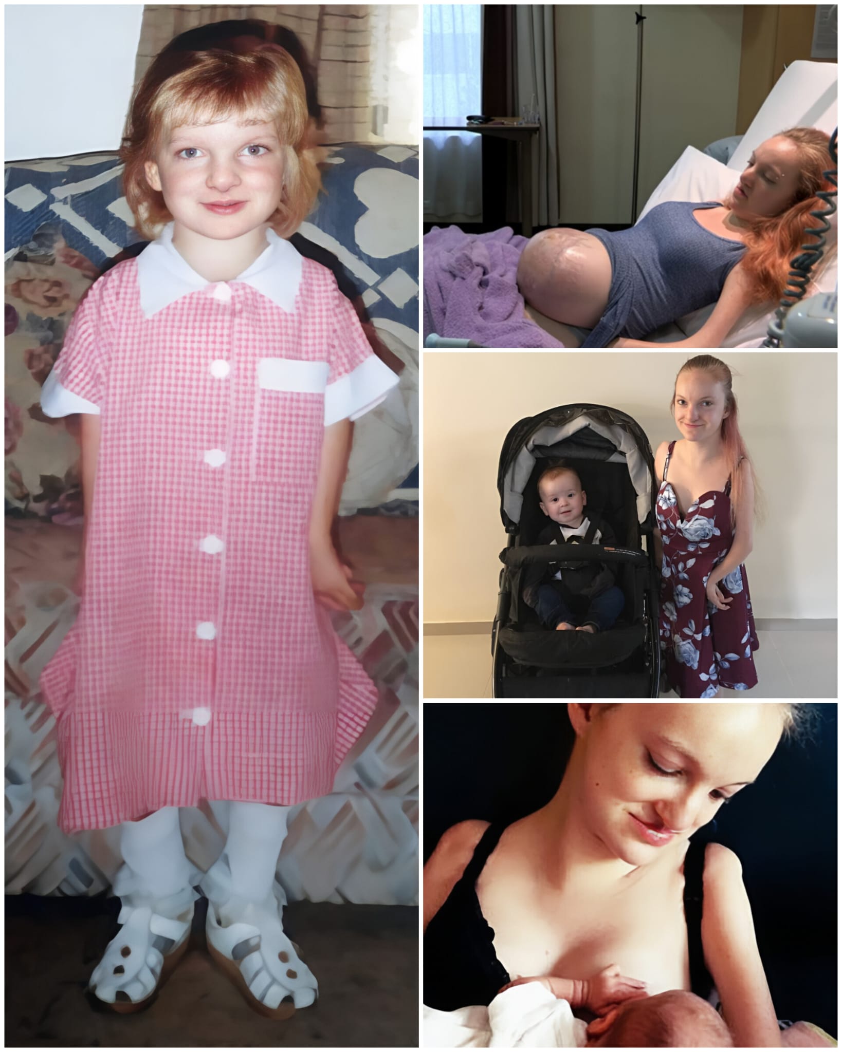 Pregnant - Young Woman Born With Almost No Muscles Defies the Odds to ...