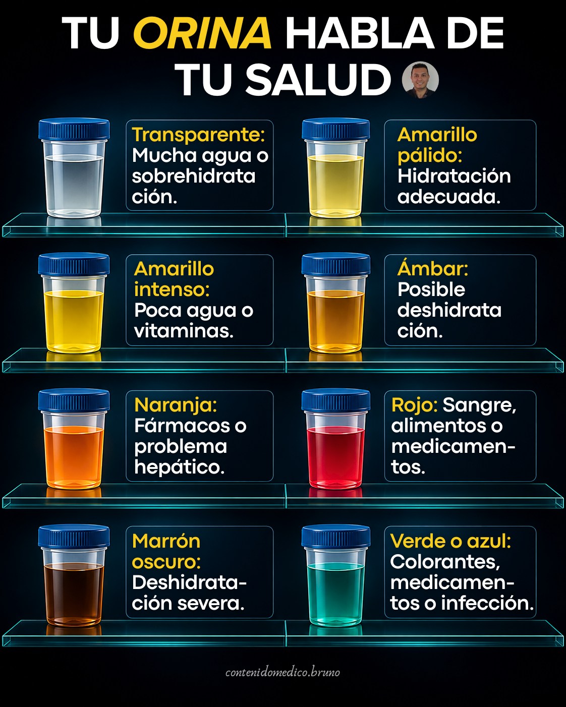 la vitamina b12 injectada causa coloracion en la orina QUÉ INDICA EL COLOR DE TU ORINA? El color de puede cambiar según cantidad de agua que tomas, los alimentos, las vitaminas, algunos medicamentos e incluso ciertas enfermedades. ━━━━━━━━━━━━ genetic testing before 5 Chemical grade:Laboratory Cyanocobalamin