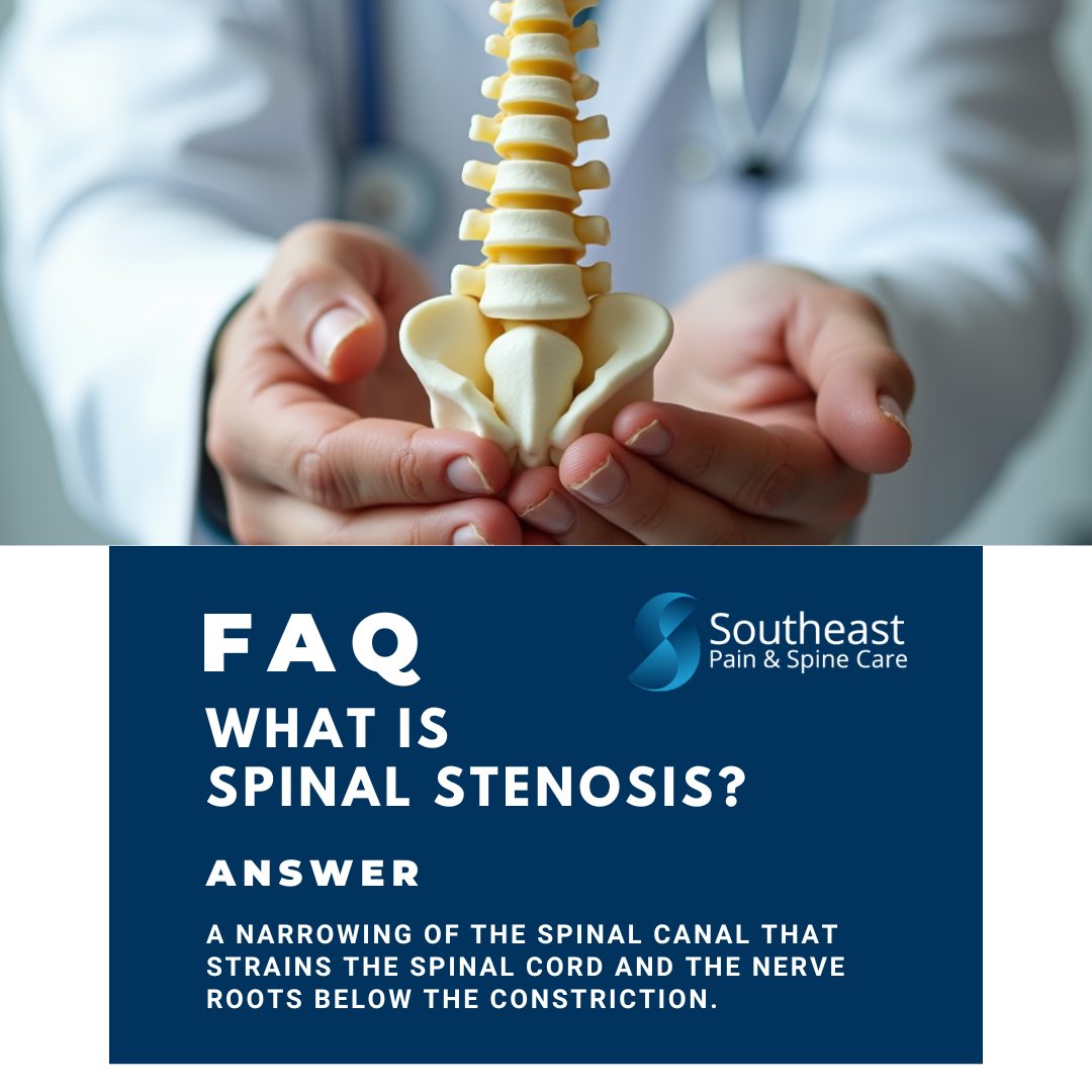 Southeast - Spinal stenosis is a condition where the canal that holds ...